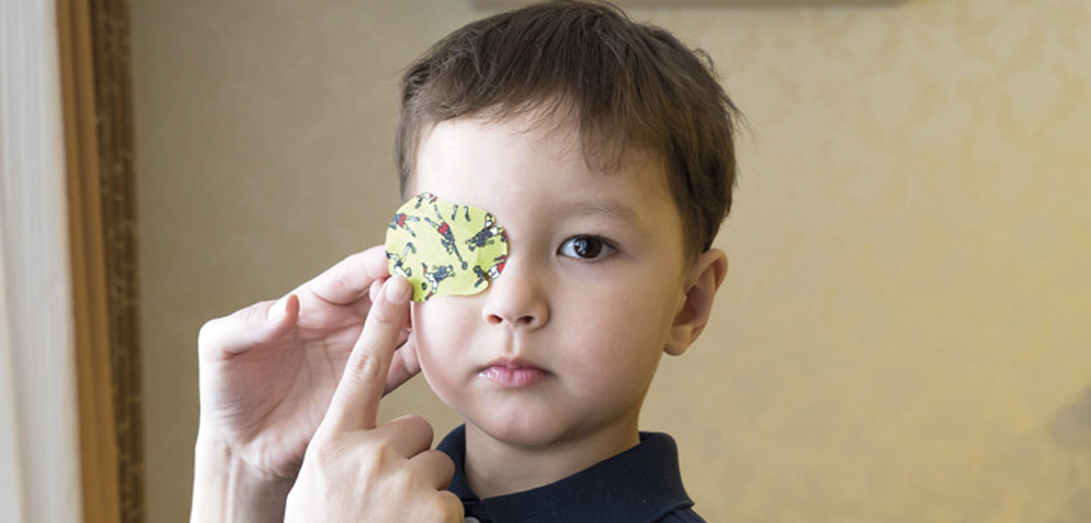 ¿Se puede corregir el ojo vago?